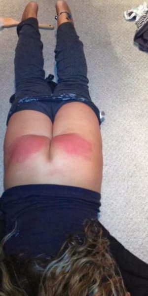 Young bottom needs attention